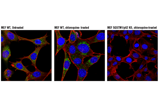 Immunofluorescence Image 1: SQSTM1/p62 (D6M5X) Rabbit mAb