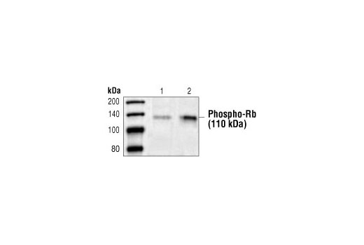 Immunoprecipitation Image 1: Phospho-(Ser) CDKs Substrate Antibody