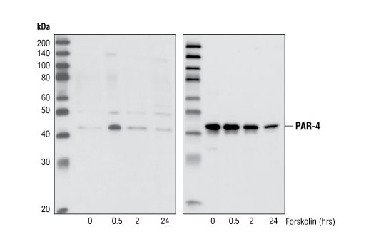 Western Blotting Image 1: Phospho-PAR-4 (Thr163) Antibody