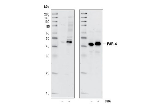 Western Blotting Image 2: Phospho-PAR-4 (Thr163) Antibody