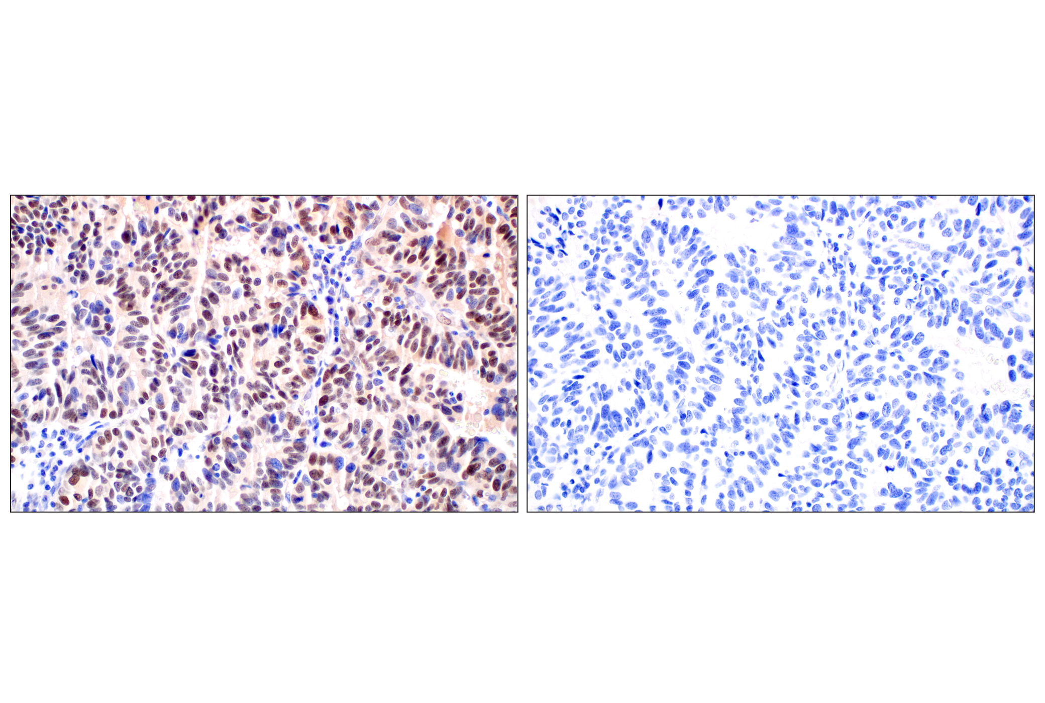 Immunohistochemistry Image 8: ID1 (F2M1J) Rabbit mAb