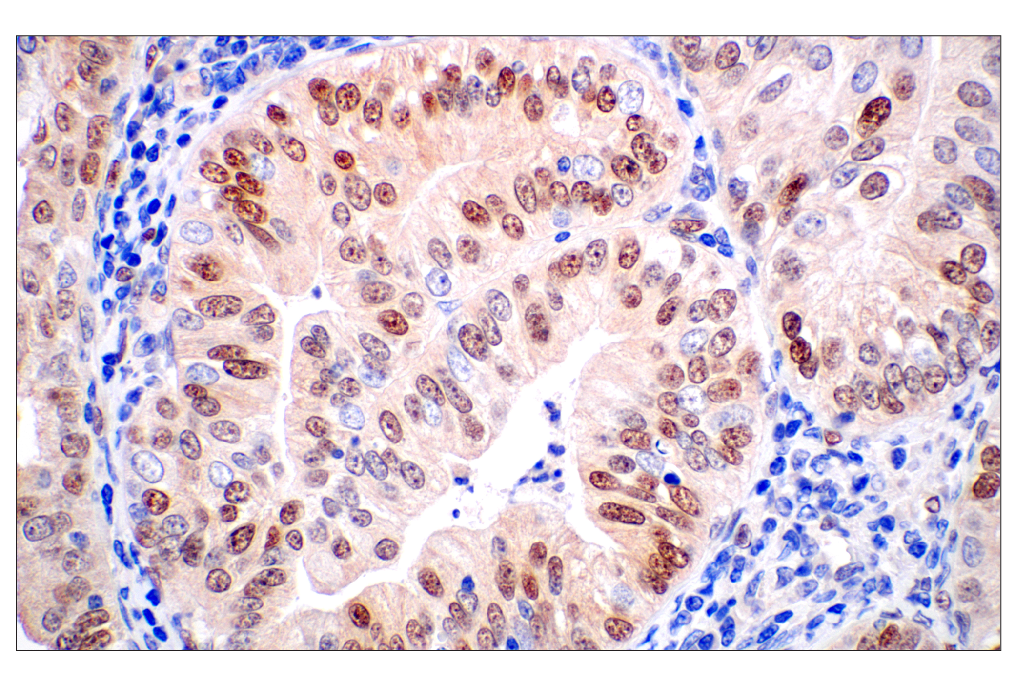 Immunohistochemistry Image 1: ID1 (F2M1J) Rabbit mAb