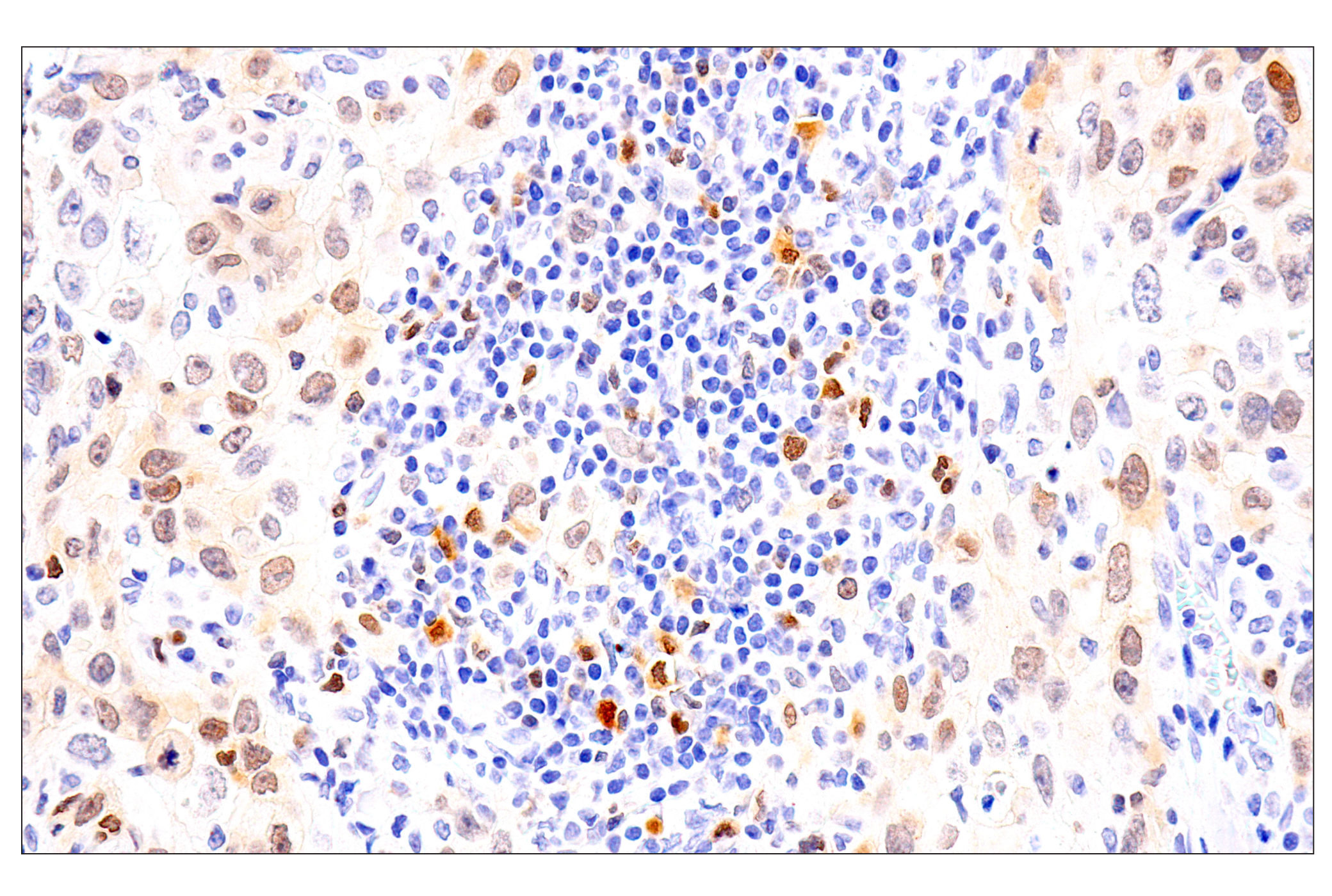 Immunohistochemistry Image 1: Chk1 (2G1D5) Mouse mAb