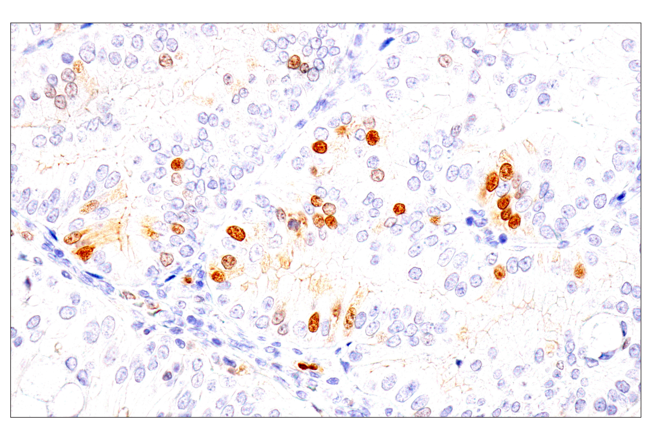 Immunohistochemistry Image 8: Chk1 (2G1D5) Mouse mAb