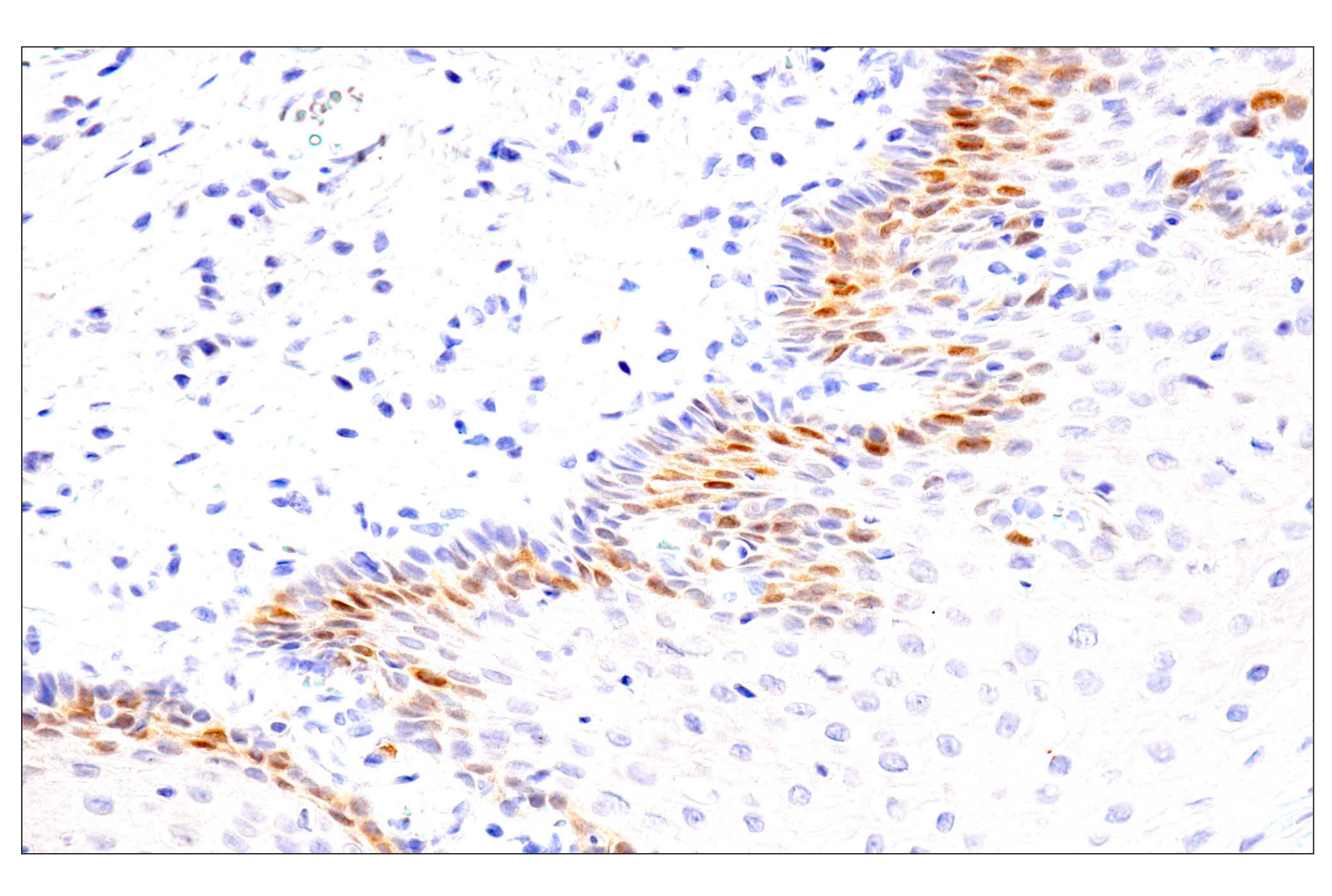 Immunohistochemistry Image 11: Chk1 (2G1D5) Mouse mAb