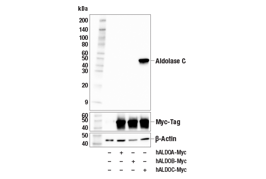 Western Blotting Image 1: Aldolase C (E7T4G) Mouse mAb