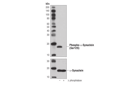 Western Blotting Image 1: Phospho-α-Synuclein (Ser129) (D1R1R) Rabbit mAb