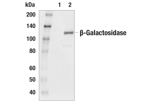 Western Blotting Image 1: β-Gal (14B7) Mouse mAb