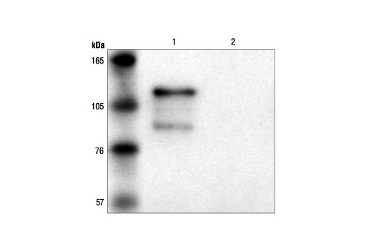 Immunoprecipitation Image 1: β-Gal (14B7) Mouse mAb