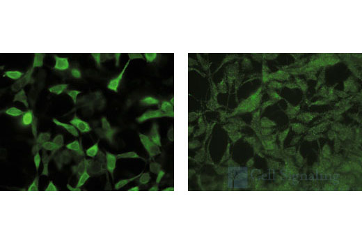 Immunofluorescence Image 1: β-Gal (14B7) Mouse mAb