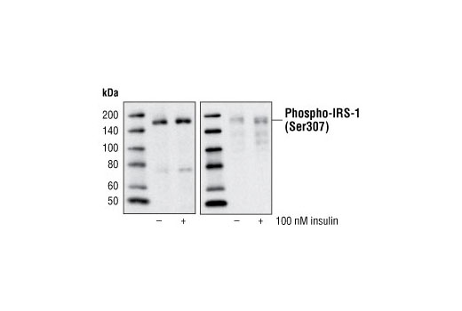  Image 1: Insulin Receptor Substrate Antibody Sampler Kit