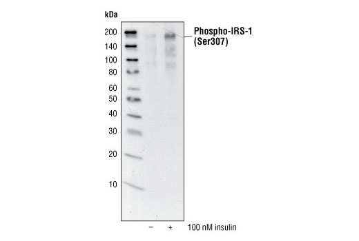  Image 10: IRS-1 Inhibition Antibody Sampler Kit