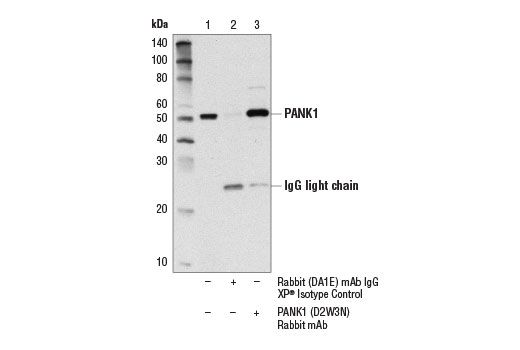 Immunoprecipitation Image 1: PANK1 (D2W3N) Rabbit mAb