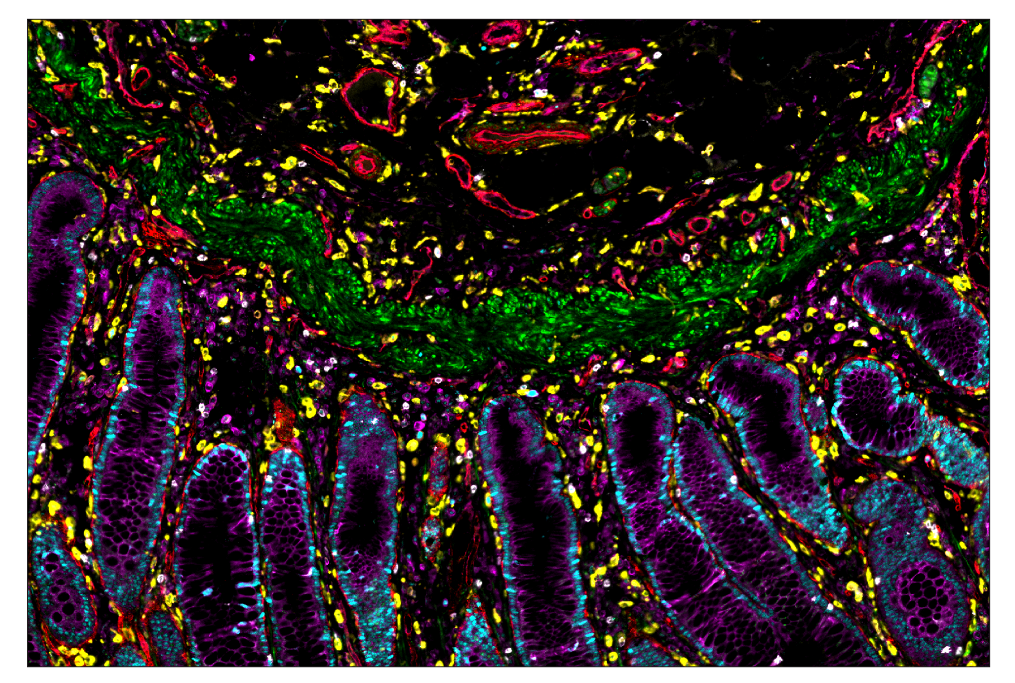 Immunohistochemistry Image 7: CD14 (D7A2T) & CO-0085-488 SignalStar™ Oligo-Antibody Pair