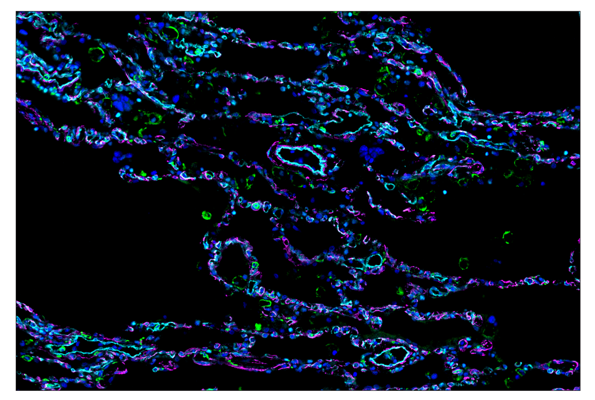 Immunohistochemistry Image 8: CD14 (D7A2T) & CO-0085-488 SignalStar™ Oligo-Antibody Pair