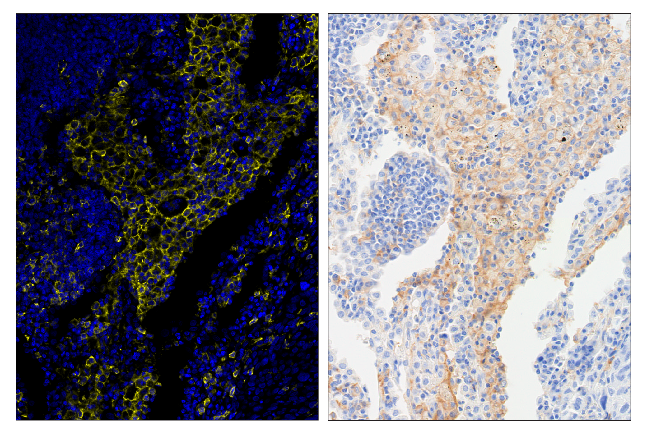 Immunohistochemistry Image 6: CD14 (D7A2T) & CO-0085-488 SignalStar™ Oligo-Antibody Pair