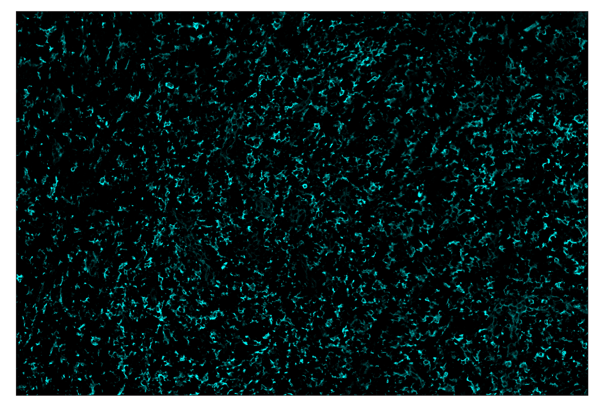 Immunohistochemistry Image 5: CD14 (D7A2T) & CO-0085-750 SignalStar™ Oligo-Antibody Pair