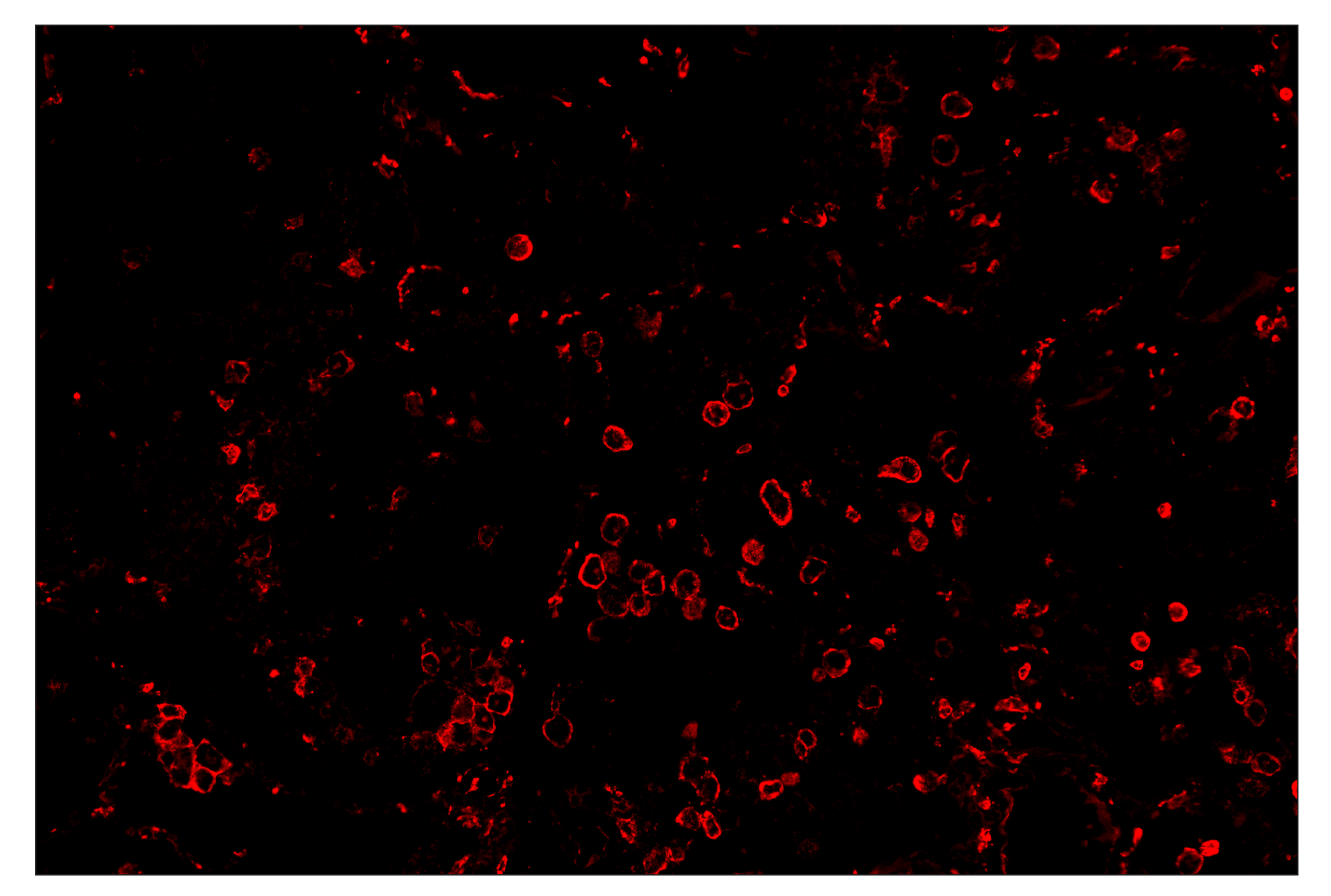 Immunohistochemistry Image 4: CD14 (D7A2T) & CO-0085-594 SignalStar™ Oligo-Antibody Pair