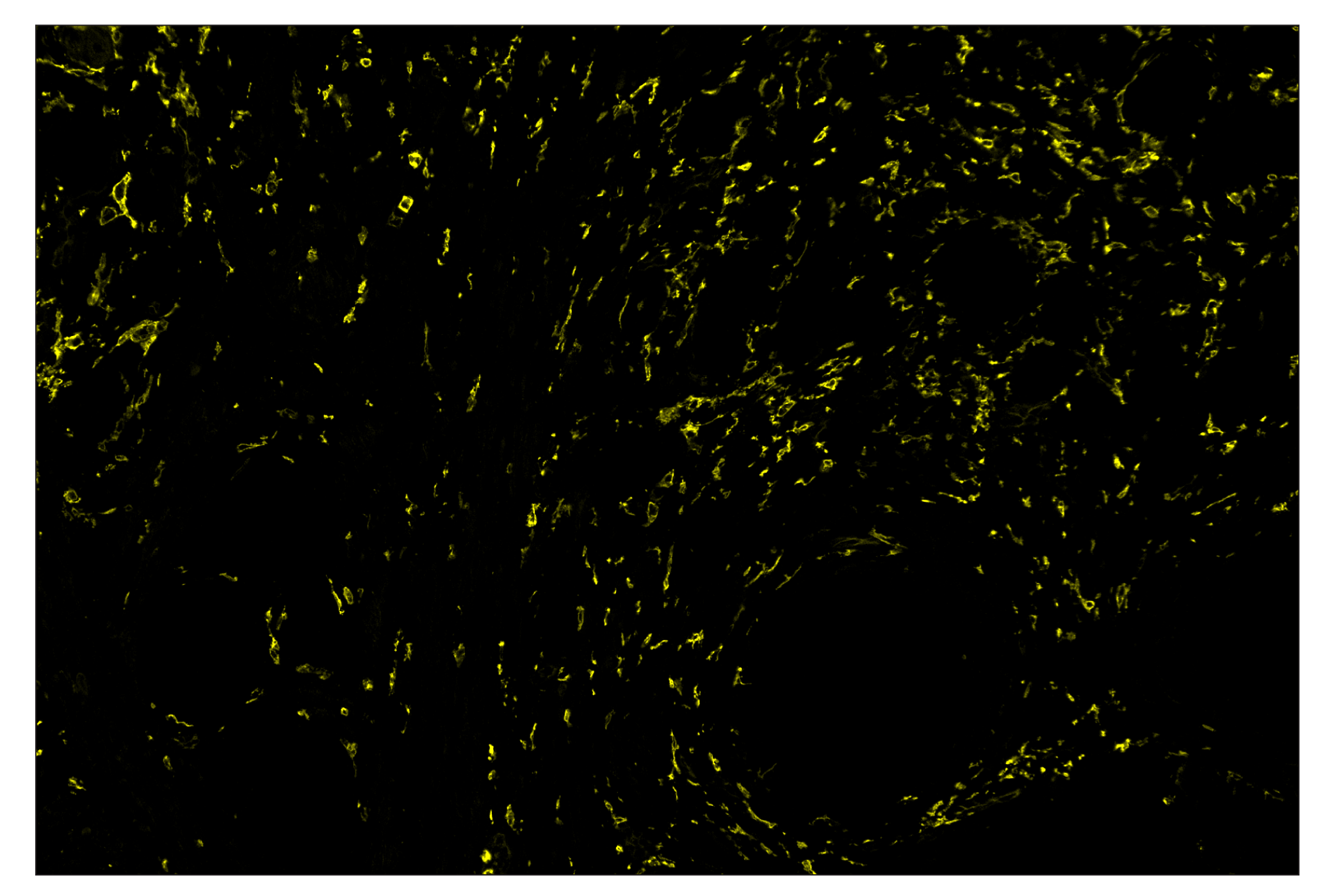Immunohistochemistry Image 3: CD14 (D7A2T) & CO-0085-647 SignalStar™ Oligo-Antibody Pair