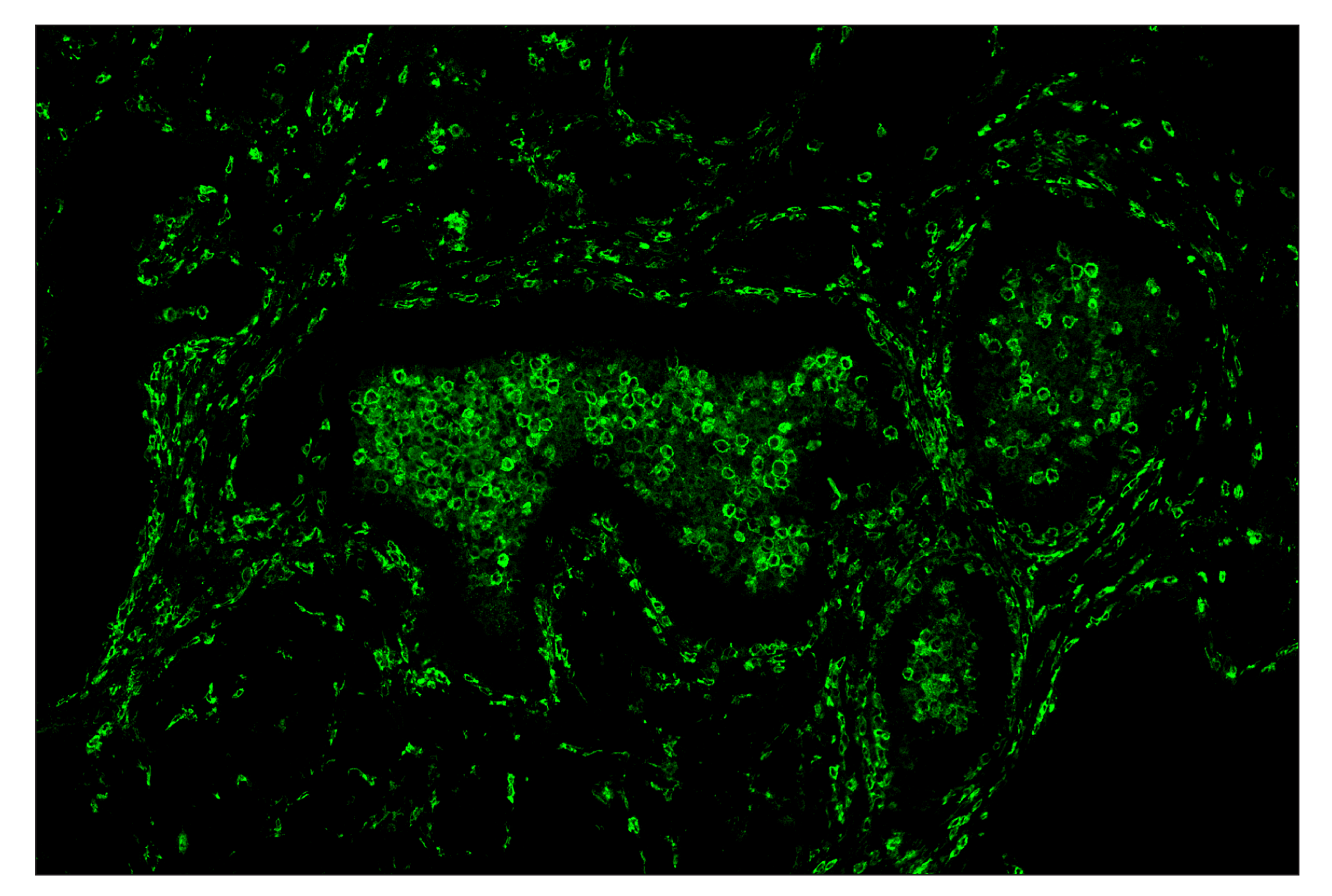 Immunohistochemistry Image 2: CD14 (D7A2T) & CO-0085-750 SignalStar™ Oligo-Antibody Pair