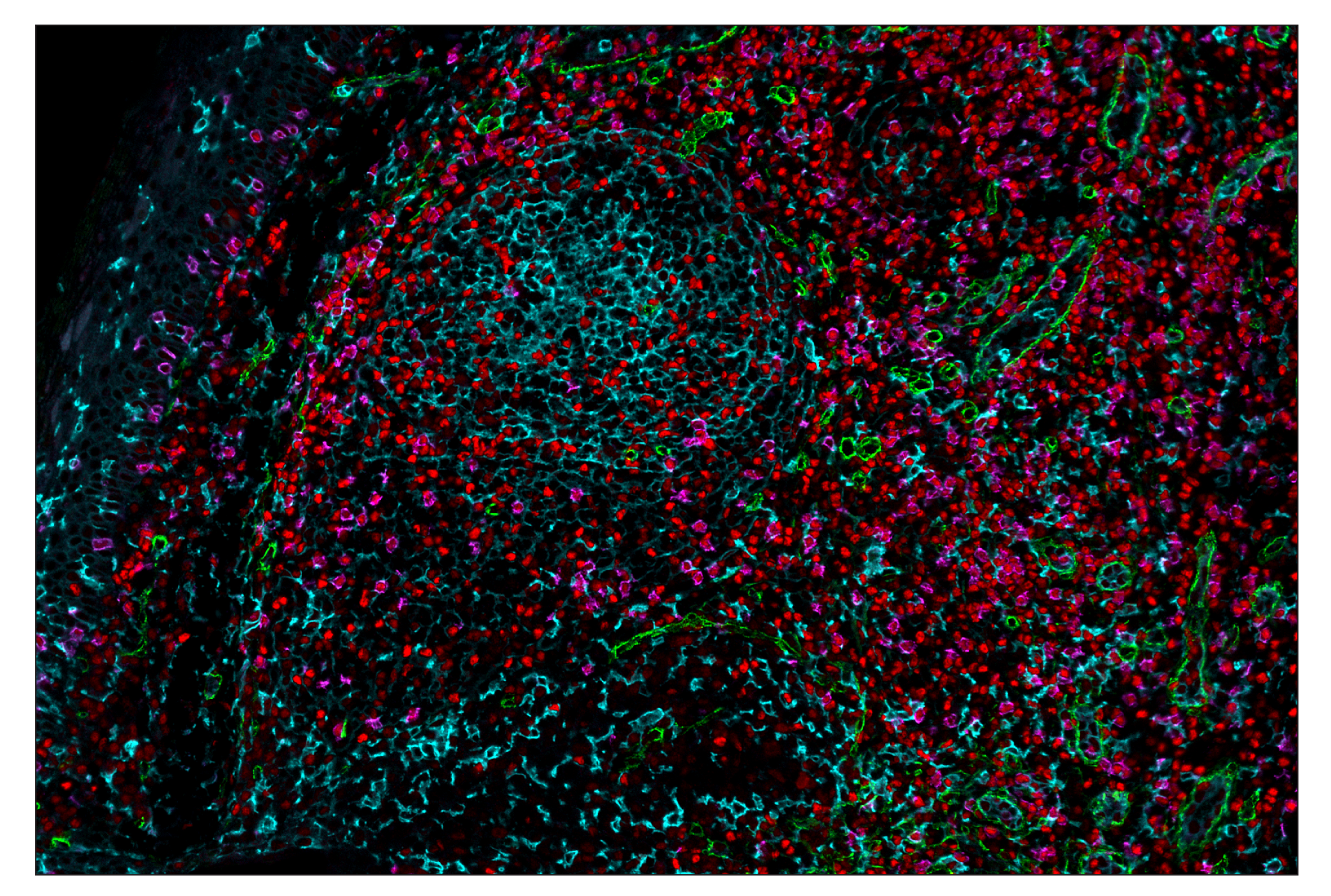 Immunohistochemistry Image 1: CD14 (D7A2T) & CO-0085-594 SignalStar™ Oligo-Antibody Pair