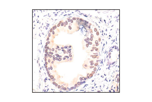 Immunohistochemistry Image 1: p14 ARF (4C6/4) Mouse mAb