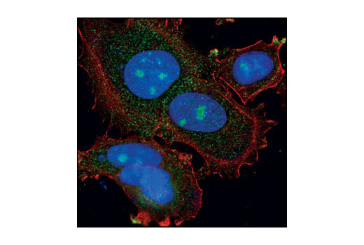 Immunofluorescence Image 1: PA28β Antibody