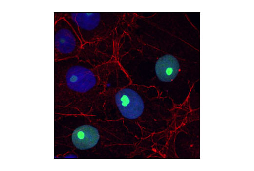 Immunofluorescence Image 1: Ribosomal Protein L7a (E109) Antibody