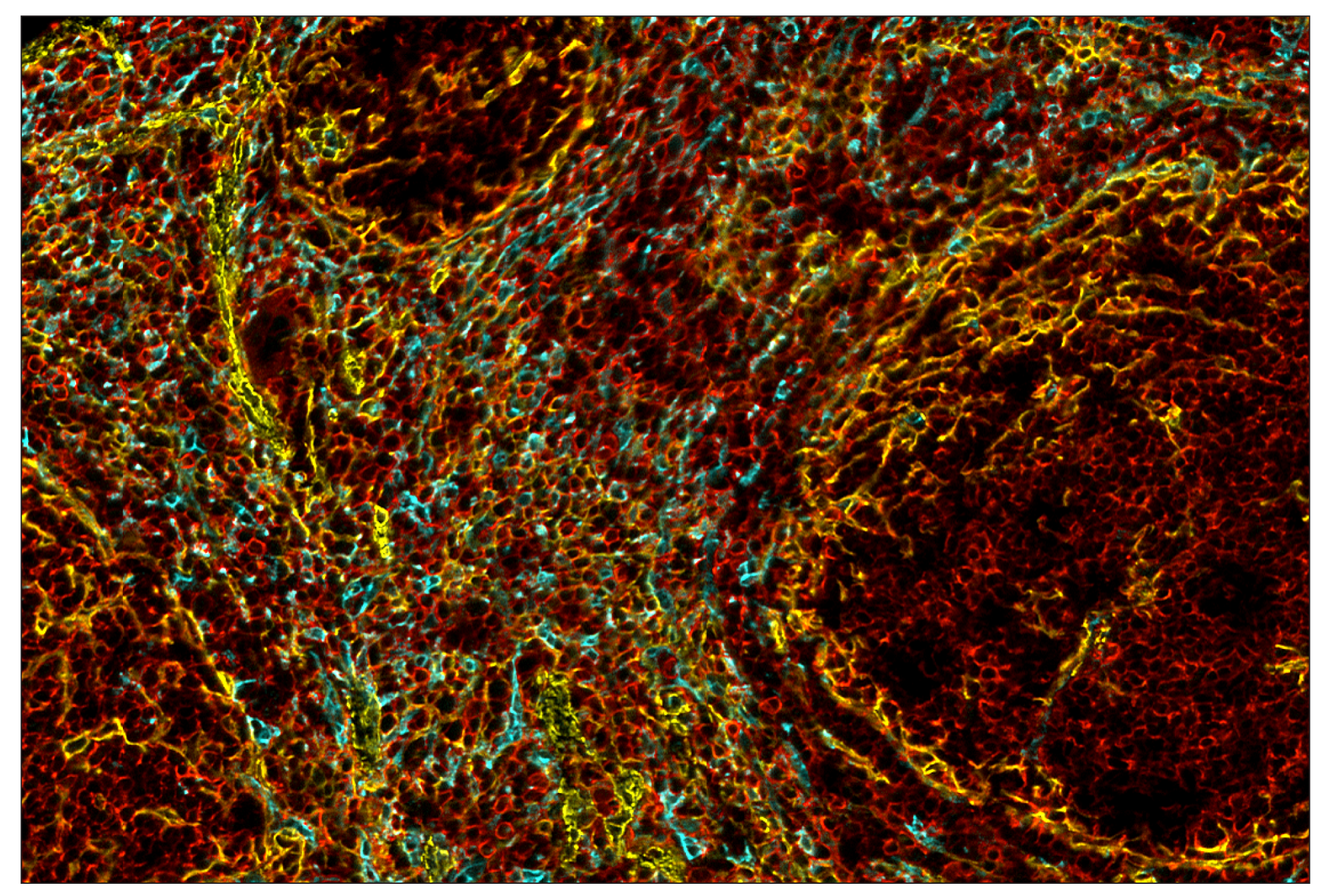 Immunohistochemistry Image 8: CD206/MRC1 (E6T5J) & CO-0032-750 SignalStar™ Oligo-Antibody Pair
