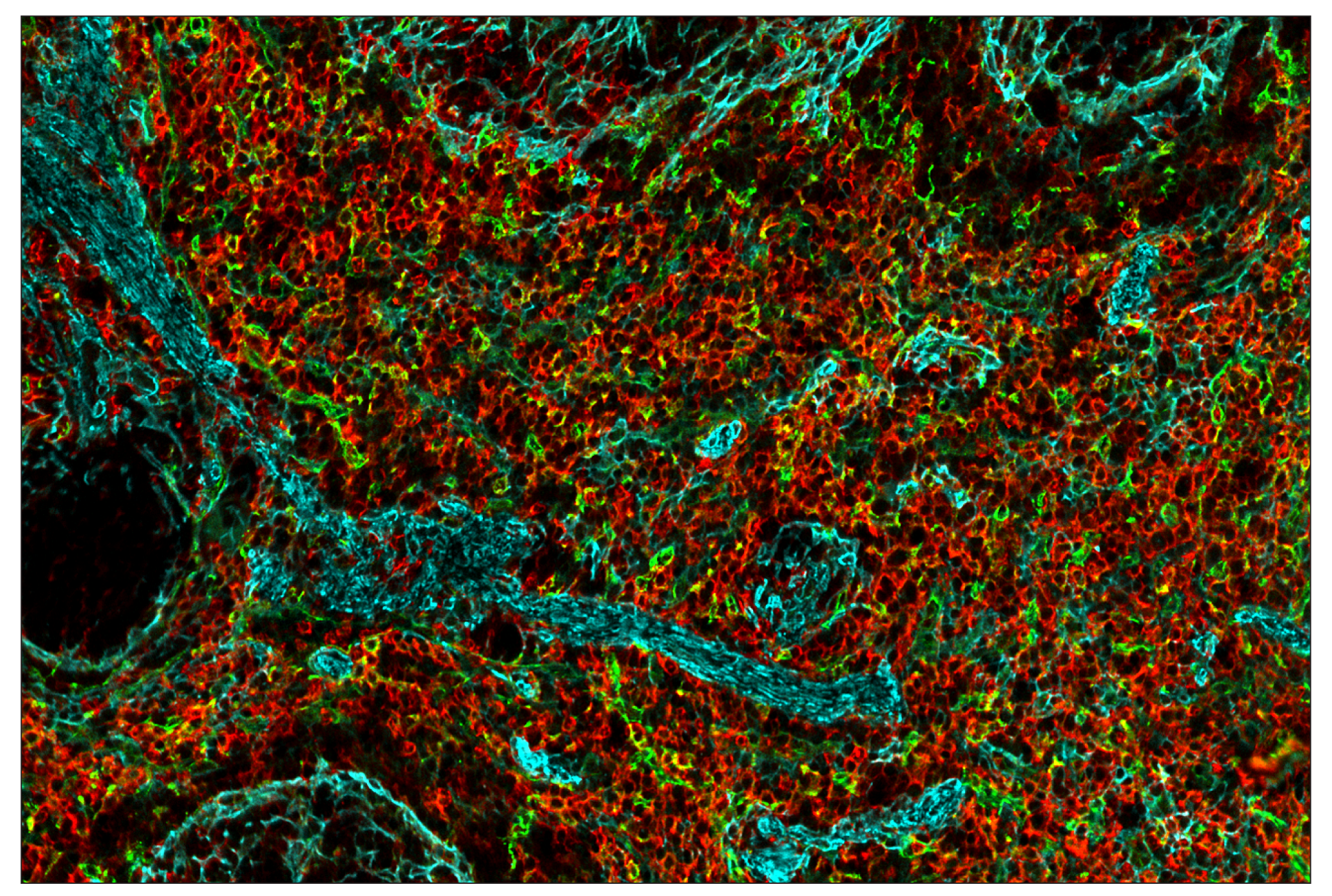 Immunohistochemistry Image 7: CD206/MRC1 (E6T5J) & CO-0032-488 SignalStar™ Oligo-Antibody Pair