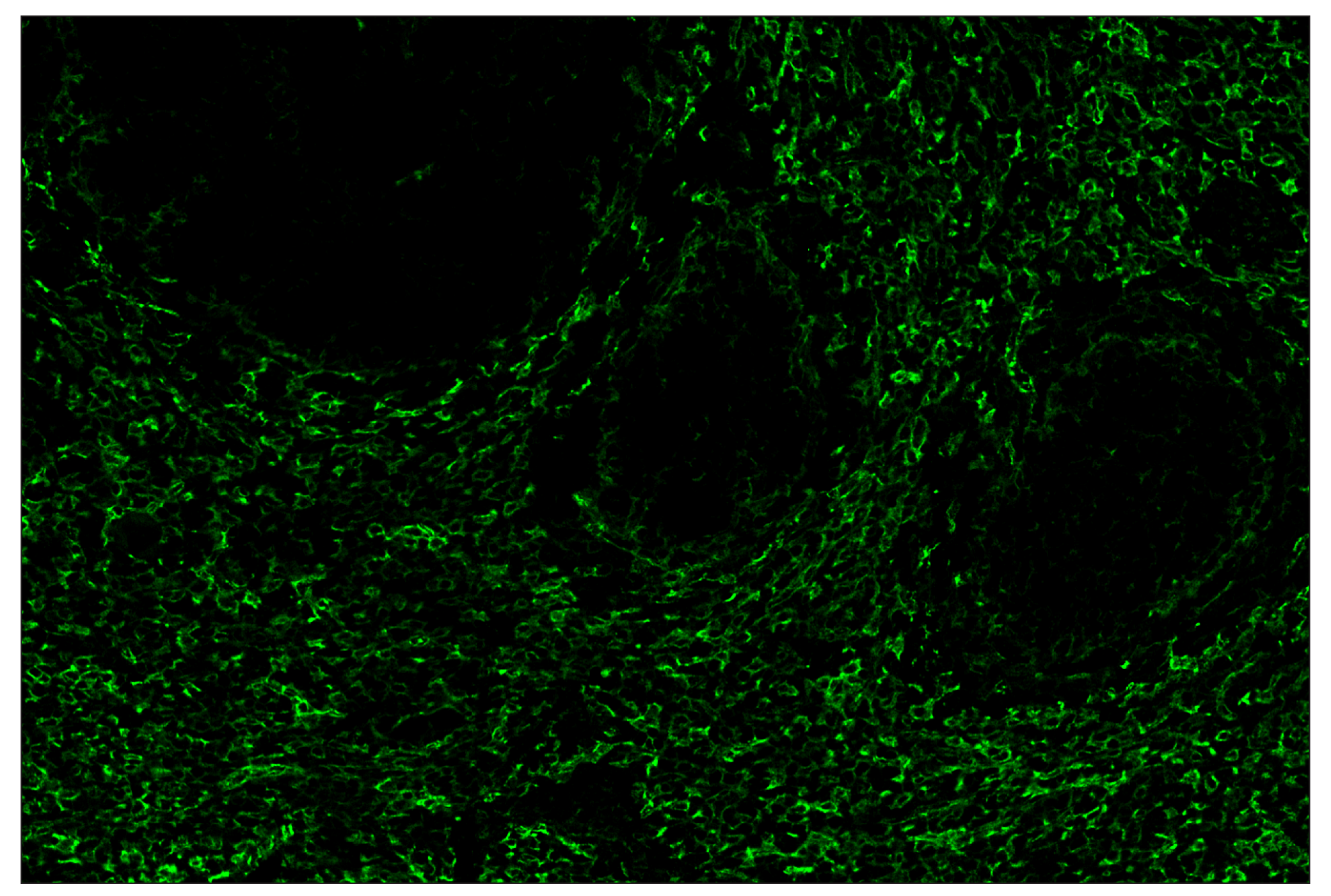 Immunohistochemistry Image 2: CD206/MRC1 (E6T5J) & CO-0032-594 SignalStar™ Oligo-Antibody Pair