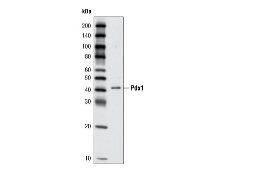 Western Blotting Image 1: Pdx1 Antibody