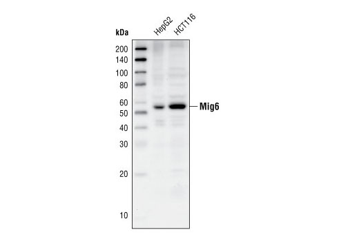 Western Blotting Image 1: Mig6 Antibody