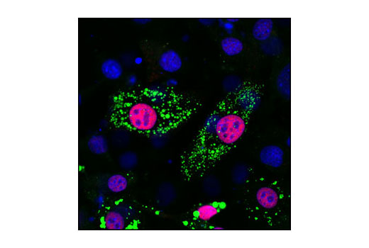 Immunofluorescence Image 1: PPARγ (81B8) Rabbit mAb