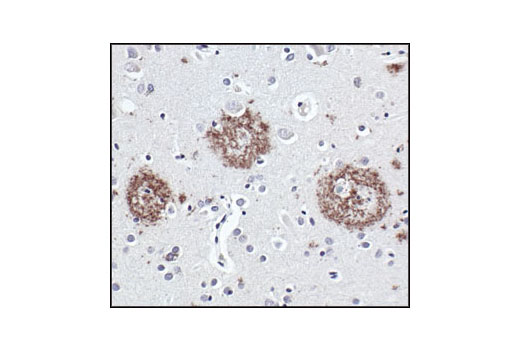  Image 12: Alzheimer's Disease Antibody Sampler Kit