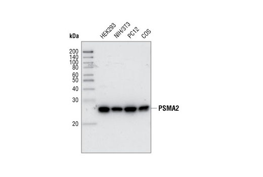 Western Blotting Image 1: PSMA2 Antibody