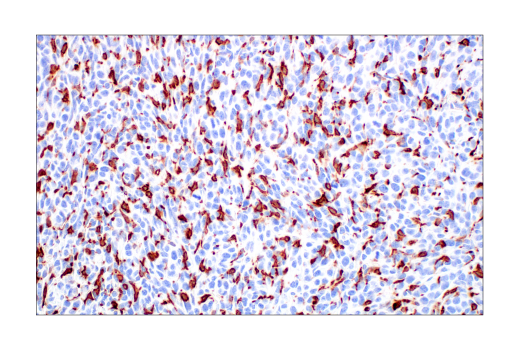 Immunohistochemistry Image 5: CD206/MRC1 (E6T5J) XP® Rabbit mAb