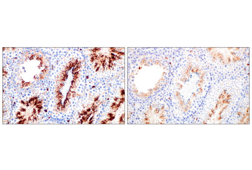 Image 79: Mouse Reactive M1 vs M2 Macrophage IHC Antibody Sampler Kit