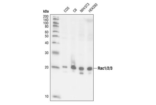 Western Blotting Image 1: Rac1/2/3 Antibody