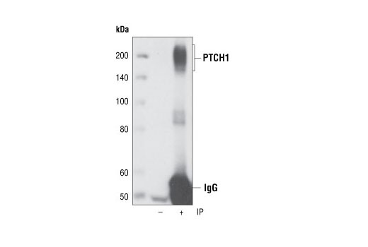 Immunoprecipitation Image 1: PTCH1 (C53A3) Rabbit mAb