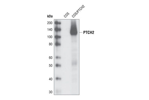Western Blotting Image 1: PTCH2 (G1191) Antibody