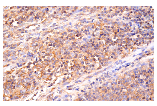 Immunohistochemistry Image 5: MYPT1 (D6C1) Rabbit mAb (BSA and Azide Free)