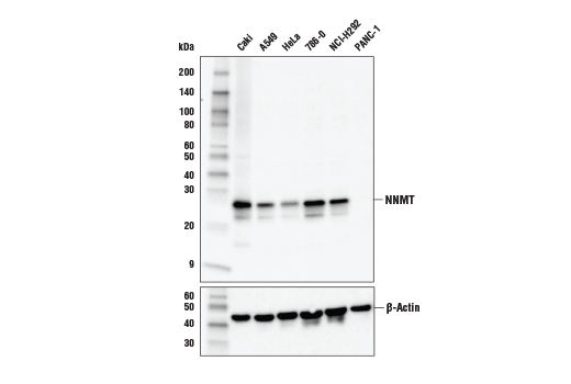 Western Blotting Image 1: NNMT Antibody