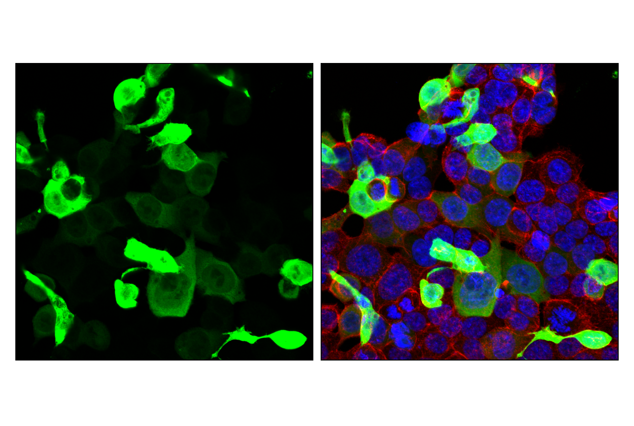 Immunofluorescence Image 1: Firefly Luciferase (E9W9V) Rabbit mAb