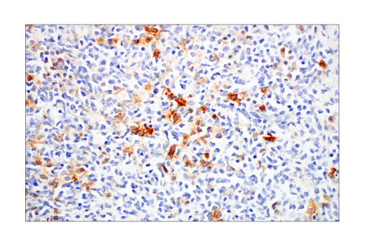 Immunohistochemistry Image 2: TNFRSF8/CD30 (E7E4D) XP® Rabbit mAb