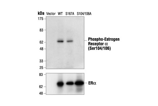 Western Blotting Image 1: Phospho-Estrogen Receptor α (Ser104/106) Antibody