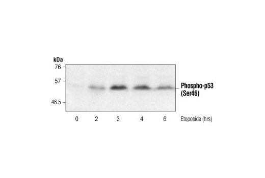 Western Blotting Image 1: Phospho-p53 (Ser46) Antibody