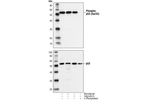 Western Blotting Image 1: Phospho-p53 (Ser33) Antibody