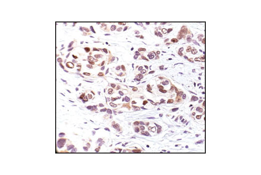  Image 14: p53 Antibody Sampler Kit