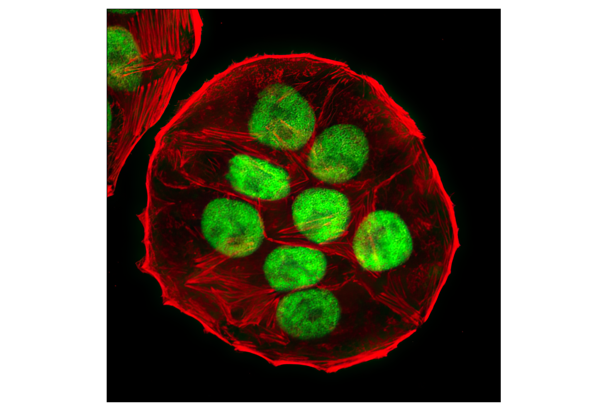 Immunofluorescence Image 1: p53 (7F5) Rabbit mAb